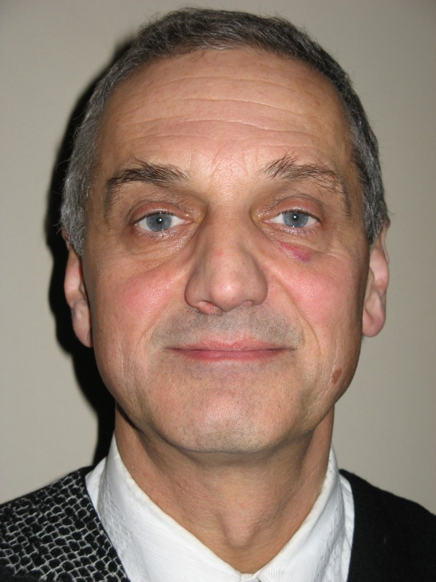 Ve Slavonicích při nehodě na kole zemřel Jan Boháč